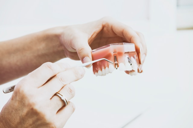 Why Are Root Canals So Expensive?