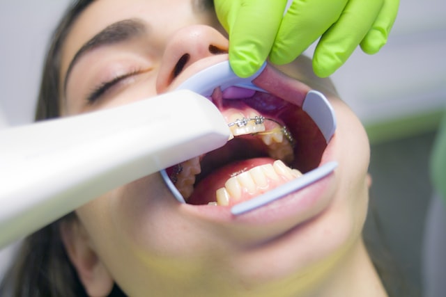 Why Is Dental Work So Expensive?